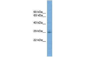 WB Suggested Anti-TMEM139 Antibody Titration: 0. (TMEM139 antibody  (N-Term))