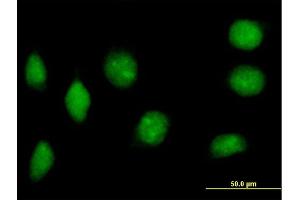Immunofluorescence of purified MaxPab antibody to NAP1L2 on HeLa cell.