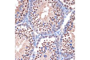 Immunohistochemistry of paraffin-embedded mouse testis using NUP153 Rabbit mAb (ABIN1512527, ABIN3023298, ABIN3023299 and ABIN7101477) at dilution of 1:100 (40x lens).