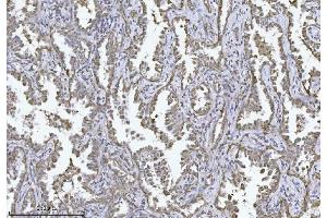 IHC analysis of PMPCB using anti-PMPCB antibody (ABIN7600757).