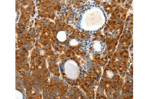 Immunohistochemistry (IHC) image for anti-Secretin Receptor (SCTR) antibody (ABIN3017416) (SCTR antibody)