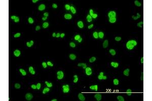 Immunofluorescence of monoclonal antibody to NFIC on HeLa cell. (NFIC antibody  (AA 1-428))