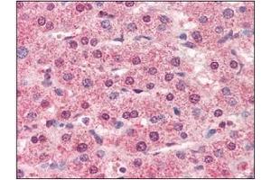 Immunohistochemistry (IHC) image for anti-Cathepsin L1 (CTSL1) (AA 114-333) antibody (ABIN317508) (Cathepsin L antibody  (AA 114-333))