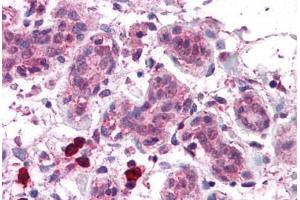 Human Breast: Formalin-Fixed, Paraffin-Embedded (FFPE) (COPS8 antibody  (C-Term))