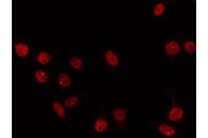 ABIN6266856 staining 293 by IF/ICC. (IRX2 antibody  (Internal Region))