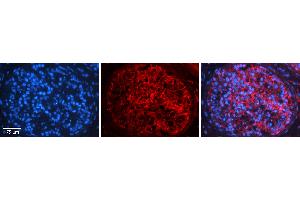 Rabbit Anti-C16ORF58 Antibody   Formalin Fixed Paraffin Embedded Tissue: Human Testis Tissue Observed Staining: Plasma membrane in spermatogonia and spermatocytes Primary Antibody Concentration: 1:100 Other Working Concentrations: N/A Secondary Antibody: Donkey anti-Rabbit-Cy3 Secondary Antibody Concentration: 1:200 Magnification: 20X Exposure Time: 0. (C16orf58 antibody  (N-Term))