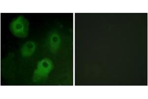 Immunofluorescence analysis of HeLa cells, using PKC delta (Ab-52) Antibody. (PKC delta antibody  (AA 18-67))