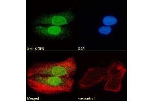 (ABIN185551) Immunofluorescence analysis of paraformaldehyde fixed U2OS cells, permeabilized with 0. (OGFR antibody  (C-Term))