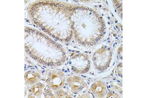 Immunohistochemistry of paraffin-embedded human stomach using CPM antibody (ABIN5975037) at dilution of 1/100 (40x lens). (CPM antibody)