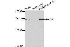 Immunoprecipitation analysis of 150ug extracts of MCF7 cells using 3ug RAD50 antibody. (RAD50 antibody  (AA 1-100))