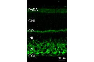 Indirect immunostaining of a PFA fixed mouse retina section (dilution 1 : 5000). (Dynamin 3 antibody  (AA 773-794))