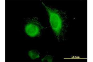 Immunofluorescence of purified MaxPab antibody to EPCAM on HeLa cell. (EpCAM antibody  (AA 1-314))