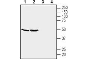 Western blot analysis of mouse kidney (lanes 1 and 3) and brain (lanes 2 and 4) lysates: - 1,2 Anti-GPR39 (extracellular) Antibody (ABIN7043159, ABIN7044429 and ABIN7044430), (1:200). (GPR39 antibody  (Extracellular))