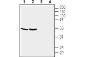 Western blot analysis of mouse kidney (lanes 1 and 3) and brain (lanes 2 and 4) lysates: - 1,2 Anti-GPR39 (extracellular) Antibody (ABIN7043159, ABIN7044429 and ABIN7044430), (1:200).