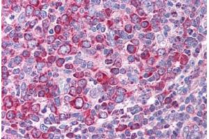 Human Tonsil (formalin-fixed, paraffin-embedded) stained with LEF1 antibody ABIN214792 at 5 ug/ml followed by biotinylated goat anti-rabbit IgG secondary antibody ABIN481713, alkaline phosphatase-streptavidin and chromogen. (LEF1 antibody  (AA 51-100))