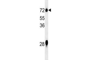 NOX3 antibody western blot analysis in mouse liver tissue lysate. (NOX3 antibody  (AA 73-102))