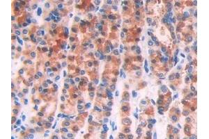 Detection of IL1R1 in Rat Stomach Tissue using Polyclonal Antibody to Interleukin 1 Receptor Type I (IL1R1) (IL1R1 antibody  (AA 119-217))