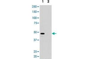 Western blot analysis of pre-incubated with (2) and without (1) blocking peptide in 293 cell lysate with MAGEA11 polyclonal antibody . (MAGEA11 antibody  (N-Term))