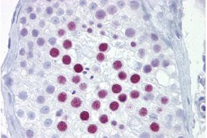 Immunohistochemistry with Testis tissue at an antibody concentration of 5µg/ml using anti-PHOX2A antibody (ARP31726_P050) (PHOX2A antibody  (N-Term))