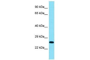 Host:  Rabbit  Target Name:  Bcl11a  Sample Type:  Mouse Heart lysates  Antibody Dilution:  1.