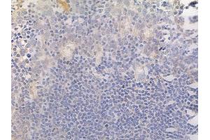 ABIN6256090 and ABIN6267276 at 1/100 staining human normal tonsil tissue by IHC-P.