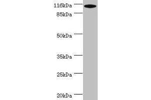 Western blot All lanes: MYO19 antibody at 2 μg/mL + A549 whole cell lysate Secondary Goat polyclonal to rabbit IgG at 1/10000 dilution Predicted band size: 110, 36, 72, 87 kDa Observed band size: 110 kDa (Myosin XIX antibody  (AA 2-770))