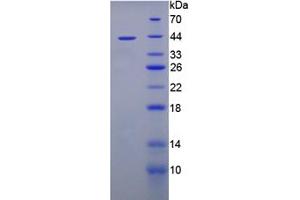 Image no. 1 for Tripeptidyl Peptidase I (TPP1) (AA 198-562) protein (His tag) (ABIN6237814)