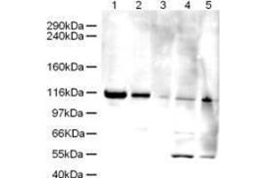 Western blot using  Affinity Purified anti-Elg1 antibody shows detection of a band ~120 kDa corresponding to human Elg1 (arrowhead) in various cell lysates. (ATAD5 antibody  (AA 63-76))