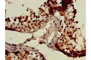 Immunohistochemistry of paraffin-embedded human testis tissue using ABIN7147659 at dilution of 1:100 (GCM2 antibody  (AA 156-451))