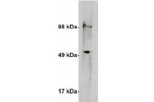 Image no. 2 for anti-serine Palmitoyltransferase, Long Chain Base Subunit 1 (SPTLC1) antibody (ABIN4620353)