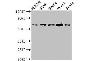 Western Blot Positive WB detected in: HEK293 whole cell lysate, A549 whole cell lysate, Mouse brain tissue, Mouse heart tissue, Rat brain tissue All lanes: PXK antibody at 2. (PXK antibody  (AA 1-200))