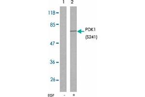 Western blot analysis of extracts from MDA-MB-435 cells using PDPK1 (phospho S241) polyclonal antibody . (PDPK1 antibody  (pSer241))
