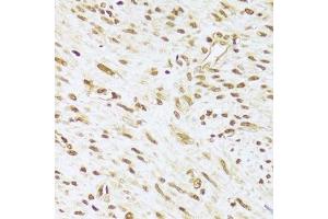 Immunohistochemistry (Paraffin-embedded Sections) (IHC (p)) image for anti-Acidic (Leucine-Rich) Nuclear phosphoprotein 32 Family, Member A (ANP32A) (AA 1-170) antibody (ABIN6136909)