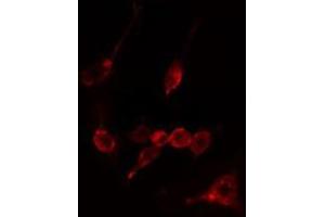 ABIN6274937 staining LOVO cells by IF/ICC. (CAPN10 antibody  (N-Term))