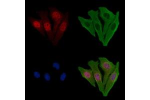 ABIN6256983 and ABIN6274937 staining Hela cells by IF/ICC.