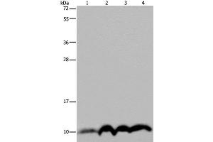 Western Blot analysis of SKOV3 cell and Human fetal liver tissue, Human fetal brain tissue and Hela cell using NDUFA4 Polyclonal Antibody at dilution of 1:300