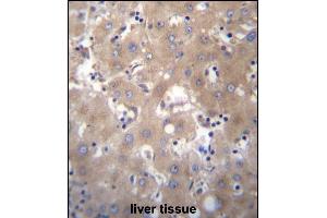 SIX5 Antibody (Center) (ABIN656668 and ABIN2845908) immunohistochemistry analysis in formalin fixed and paraffin embedded human liver tissue followed by peroxidase conjugation of the secondary antibody and DAB staining. (Six5 antibody  (AA 257-286))