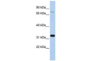 CACNB2 antibody used at 1 ug/ml to detect target protein. (CACNB2 antibody  (N-Term))