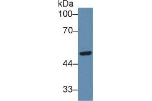 Detection of SFRP4 in Human Hela cell lysate using Polyclonal Antibody to Secreted Frizzled Related Protein 4 (SFRP4) (SFRP4 antibody  (AA 265-346))