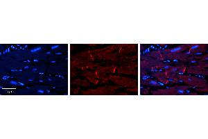 Rabbit Anti-AKT2 Antibody   Formalin Fixed Paraffin Embedded Tissue: Human heart Tissue Observed Staining: Cytoplasmic, plasma membrane in intercalated disc Primary Antibody Concentration: 1:100 Other Working Concentrations: 1:600 Secondary Antibody: Donkey anti-Rabbit-Cy3 Secondary Antibody Concentration: 1:200 Magnification: 20X Exposure Time: 0. (AKT2 antibody  (Middle Region))