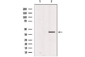 Western blot analysis of extracts from rat brain, using PSAT1 antibody. (PSAT1 antibody  (Internal Region))