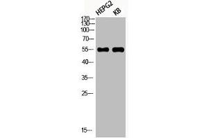 Western Blot analysis of HEPG2 KB using Phospho-Akt1 (S246) Polyclonal Antibody (AKT1 antibody  (pSer246))