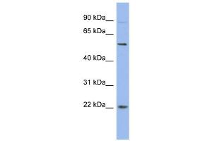 WB Suggested Anti-HMGB4 Antibody Titration:  0. (HMGB4 antibody  (N-Term))