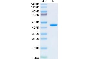 Human B2M on Tris-Bis PAGE under reduced condition. (beta-2 Microglobulin Protein (AA 21-119) (Fc Tag))