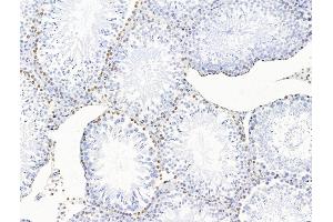 ABIN7094735 and ABIN7098786 at 1/100 staining Rat testis tissue by IHC-P. (POLQ antibody  (Internal Region))
