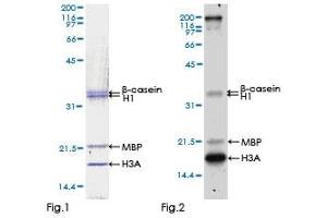 EEF2K Protein (AA 1-725) (GST tag)