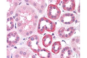 Immunohistochemistry (IHC) image for anti-HNF1 Homeobox A (HNF1A) (N-Term) antibody (ABIN2784536) (HNF1A antibody  (N-Term))