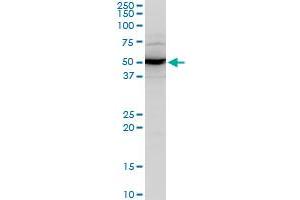 ABHD5 polyclonal antibody (A02), Lot # 060103JC01. (ABHD5 antibody  (AA 240-342))