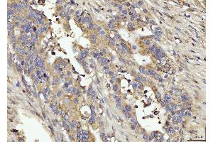 IHC analysis of BIN1 using anti-BIN1 antibody (ABIN7601780).