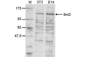 Western Blot of anti-Brd2 antibody Western Blot results of Rabbit anti-Brd2 antibody. (BRD2 antibody  (Internal Region))